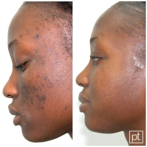 Gamme corps et visage peau